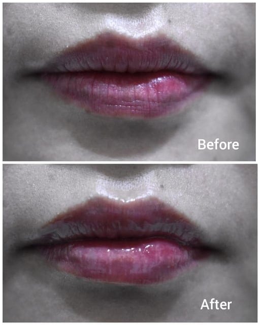 bonamedusa Lip Wave Delete(改善唇紋)。秋冬唇部不再乾巴巴。安撫肌膚煩惱系列，高品質的機能性保養品，成分溫和對肌膚零傷害