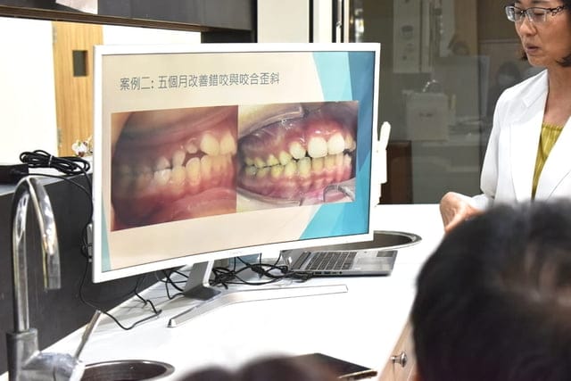 台中光流牙科隱適美說明會。黃汝萍醫師。隱適美隱形矯正認證醫師。不拔牙矯正。隱形牙套，矯正牙齒不疼痛，可以正常吃東西