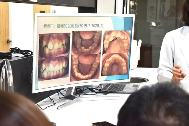 台中光流牙科隱適美說明會。黃汝萍醫師。隱適美隱形矯正認證醫師。不拔牙矯正。隱形牙套，矯正牙齒不疼痛，可以正常吃東西
