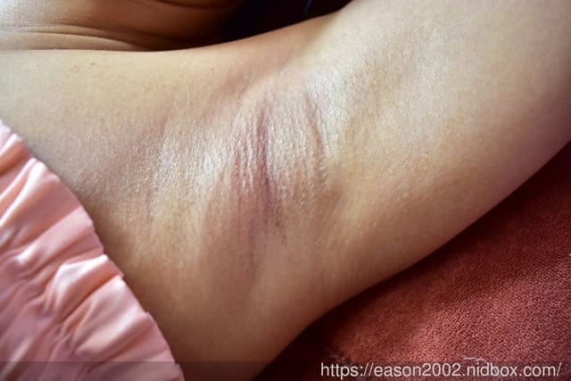桃園美容SPA。#恩蓓拉WAXING 中正館。舉手掰掰不用怕。腋下熱蠟除毛