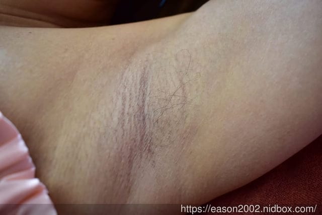 桃園美容SPA。#恩蓓拉WAXING 中正館。舉手掰掰不用怕。腋下熱蠟除毛