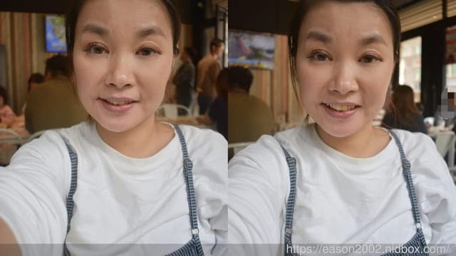 台北水光槍推薦 | 青熙美學診所 忠孝院所 海庫斯水光槍 +肉毒除皺（抬頭紋）潤澤、緊緻、平滑 快速達成